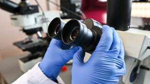 Hausse des cancers colorectaux chez les moins de 50 ans: des causes encore myst&eacute;rieuses