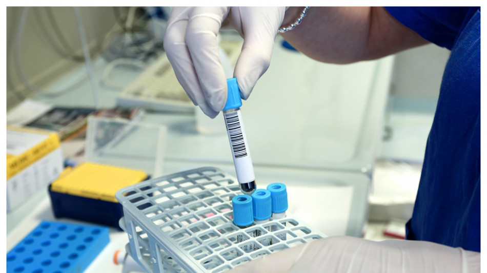  Gli organi invecchiano in tempi diversi, lo indica un'analisi del sangue 