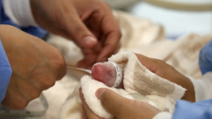 Berliner Zoo zeigt sich erfreut &uuml;ber Entwicklung junger Pandazwillinge