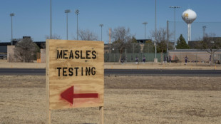 L'épidémie de rougeole aux Etats-Unis dépasse les 1.000 cas et trois morts