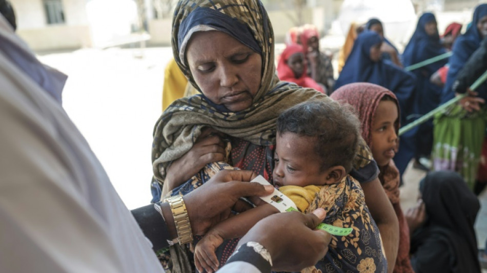 La desnutrici&oacute;n infantil se dispara en Etiop&iacute;a debido a la sequ&iacute;a (ONG)