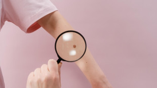 Melanoma e tumore polmone, ok Aifa per nivolumab stadio precoce