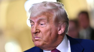 Trump, diagnosticado con insuficiencia venosa cr&oacute;nica tras hinchaz&oacute;n en las piernas