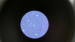 Dans l'espace, les spermatozo&iuml;des ont du mal &agrave; trouver leur chemin
