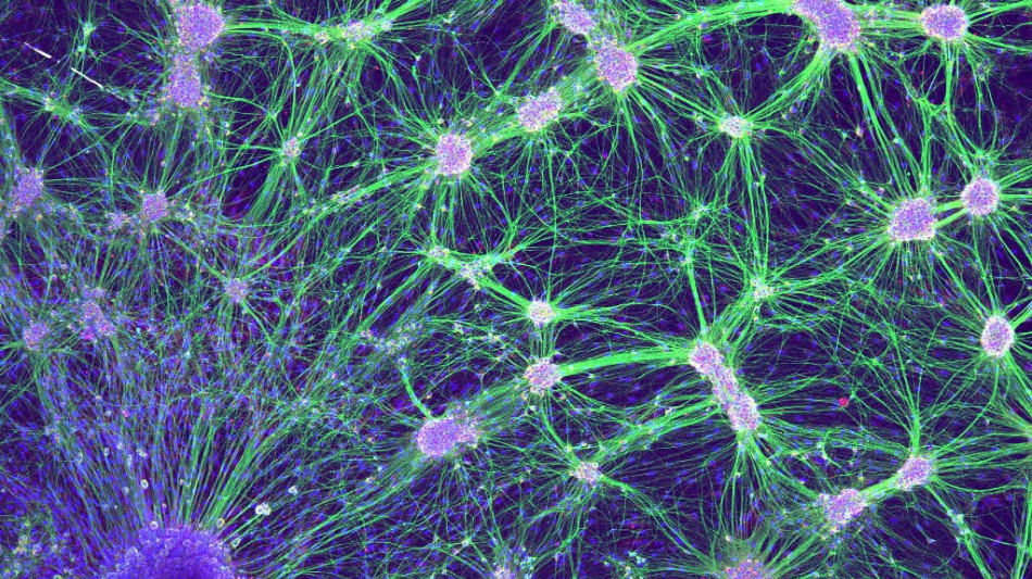  Depressione e Alzheimer, con terapia magnetica risultati migliori rispetto a farmaci 