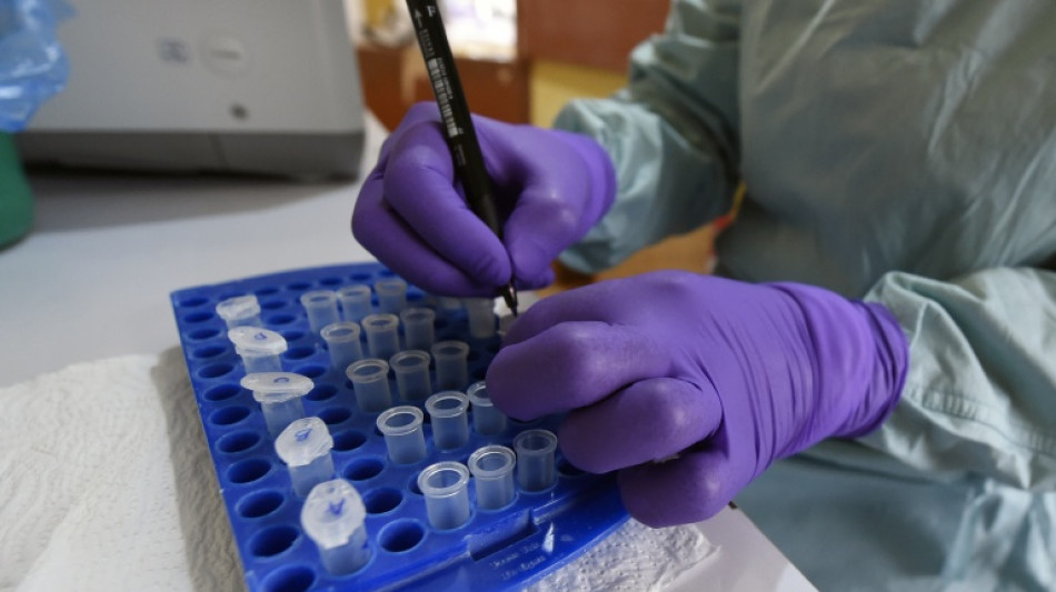  Au Nigeria, le "choc" apr&egrave;s l'annonce d'un premier cas d'Ebola de souche Bundibugyo 