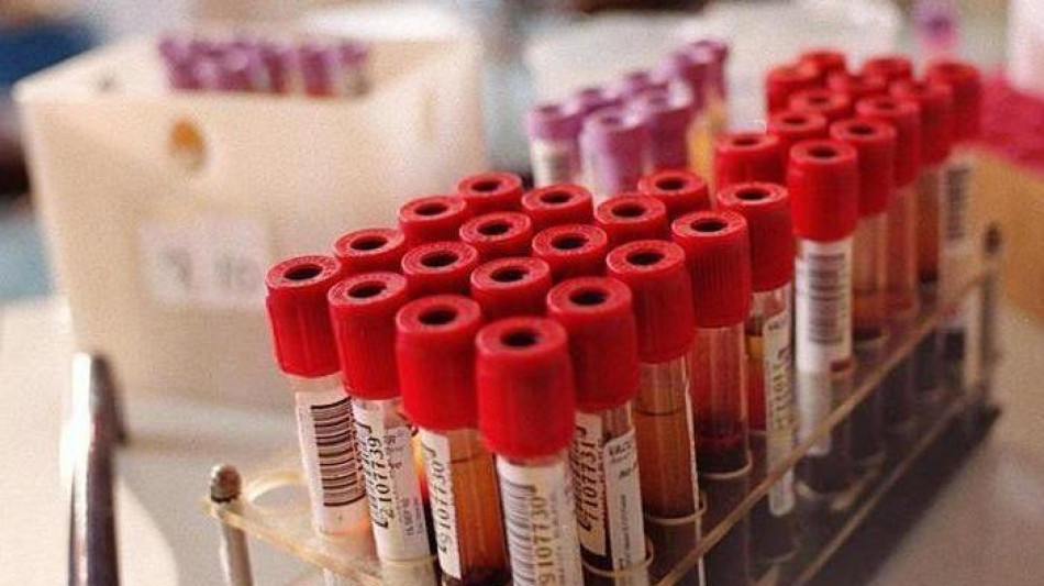  Spento l'allarme che fa invecchiare le cellule del sangue 