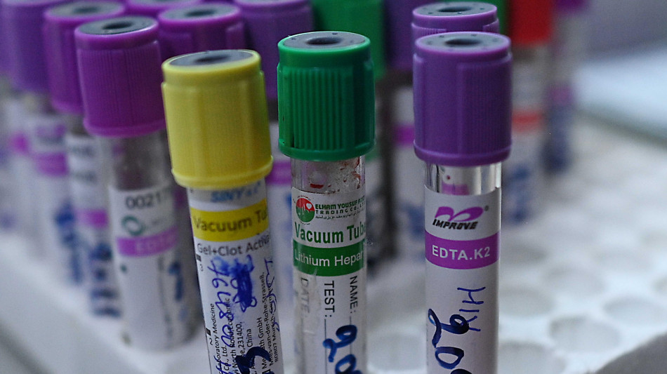  Caccia ai test per il virus Andes, i dubbi sul contagio dagli asintomatici 