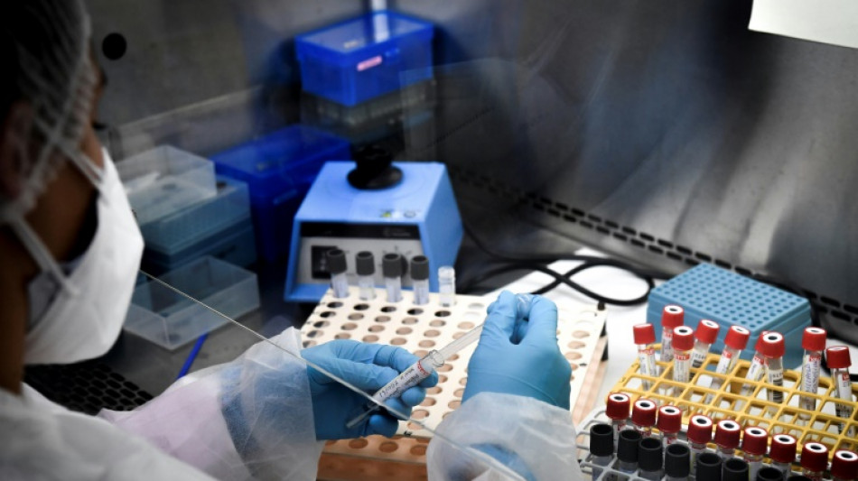 Sant&eacute;: toujours pas d'accord avec la S&eacute;cu, les biologistes menacent d'un "janvier noir"