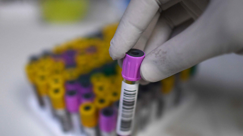  Tubercolosi, verso test sangue ultra-sensibile per diagnosi infezione latente o iniziale 
