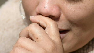 Tener calor en la nariz ayuda a combatir los resfriados, se&ntilde;ala estudio