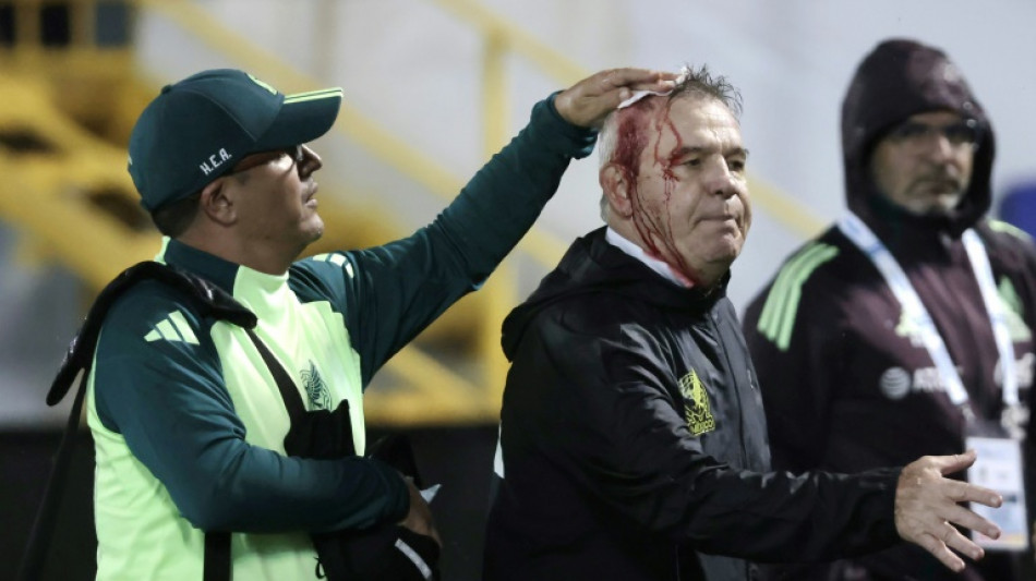 T&eacute;cnico do M&eacute;xico &eacute; ferido na cabe&ccedil;a por torcedores em derrota para Honduras