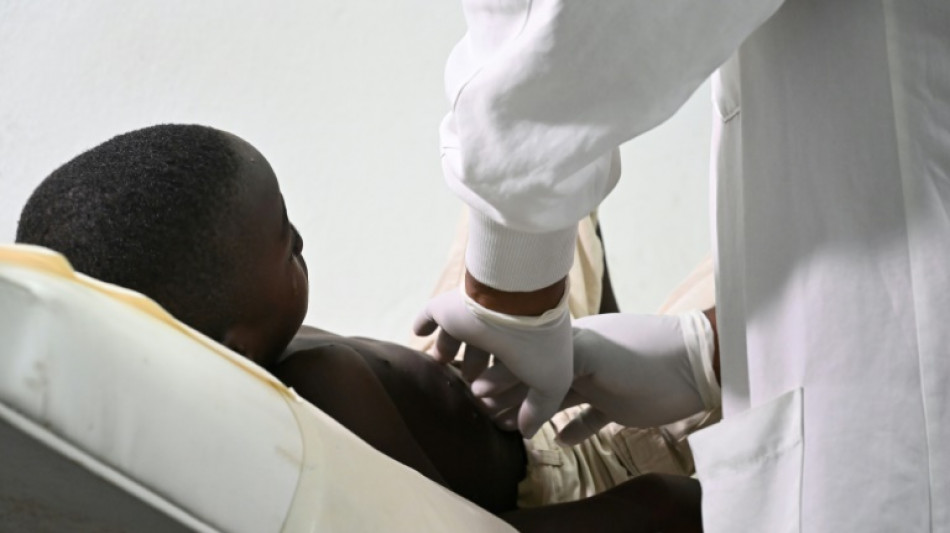 C&ocirc;te d'Ivoire: 28 cas de mpox recens&eacute;s dont un d&eacute;c&egrave;s