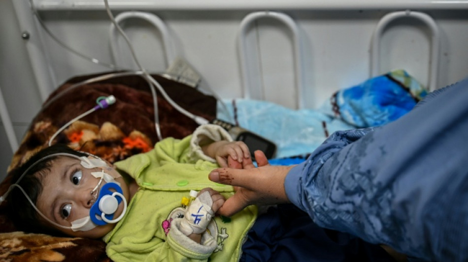  La desnutrici&oacute;n aguda infantil alcanza niveles cr&iacute;ticos en Afganist&aacute;n, seg&uacute;n la ONU 