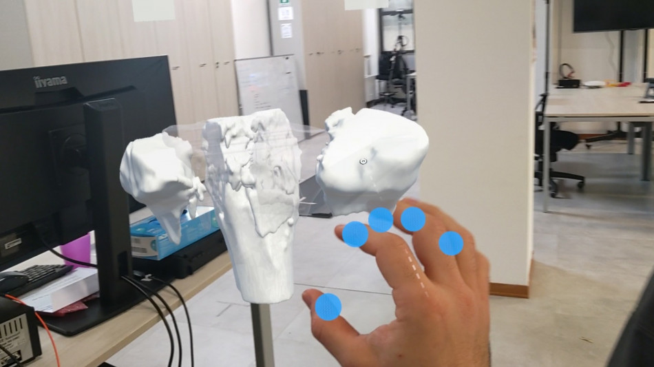  Dispositivi tattili aiutano i chirurghi a 'sentire' con le mani 