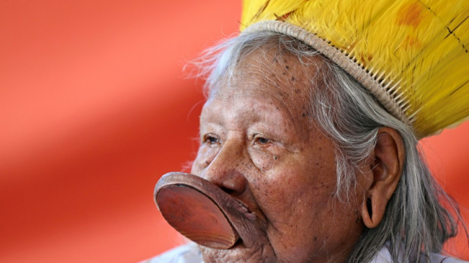  Amazonian tribal leader Raoni hospitalized in intensive care 